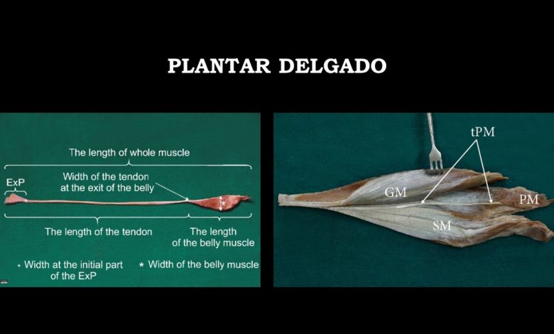 Photo of Músculo plantar delgado y su relación con patología del Aquiles y tibial posterior.